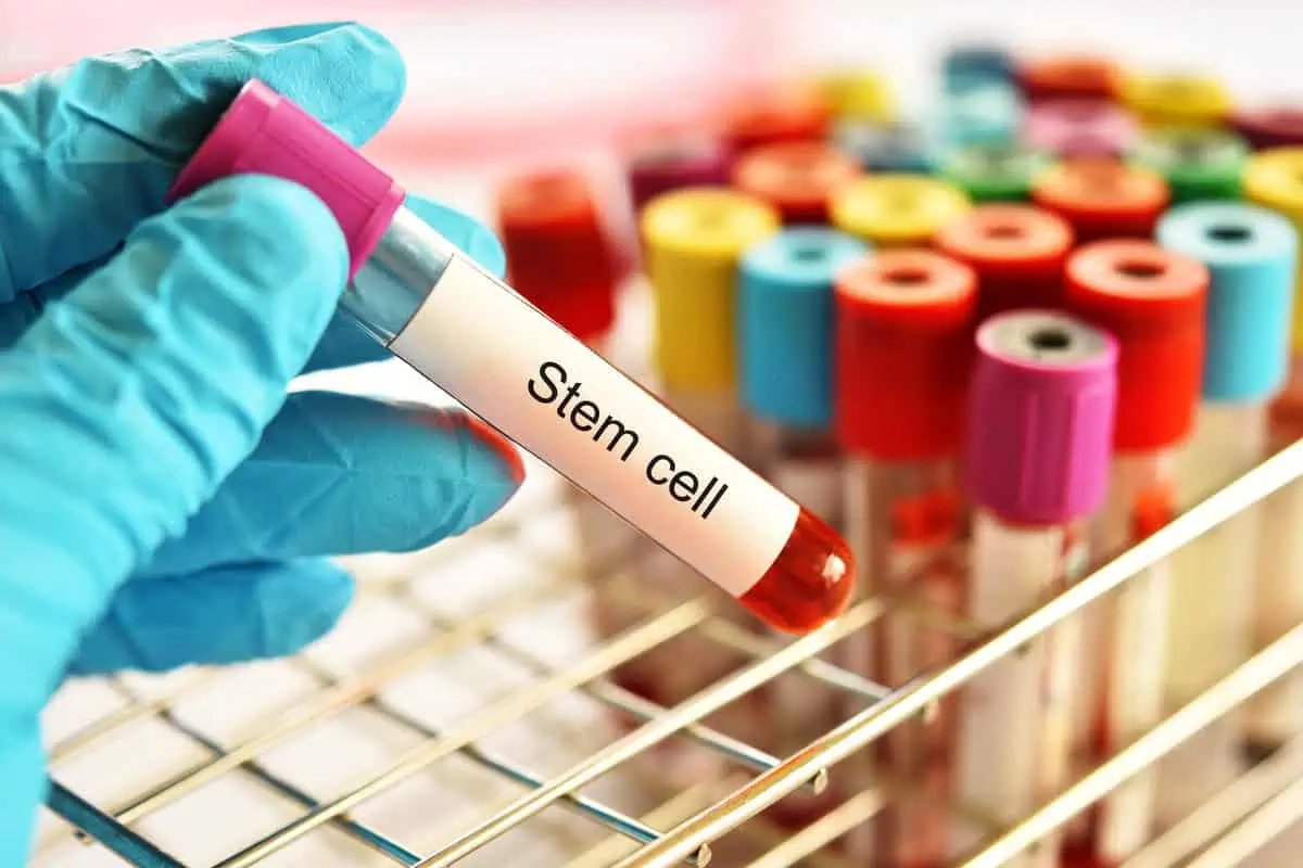 A Novel Method for Monitoring Stem Cells with MRI