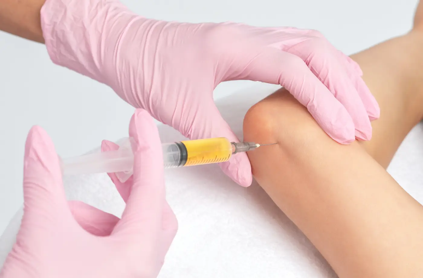 Close-up of stem cell therapy injection for joint pain relief