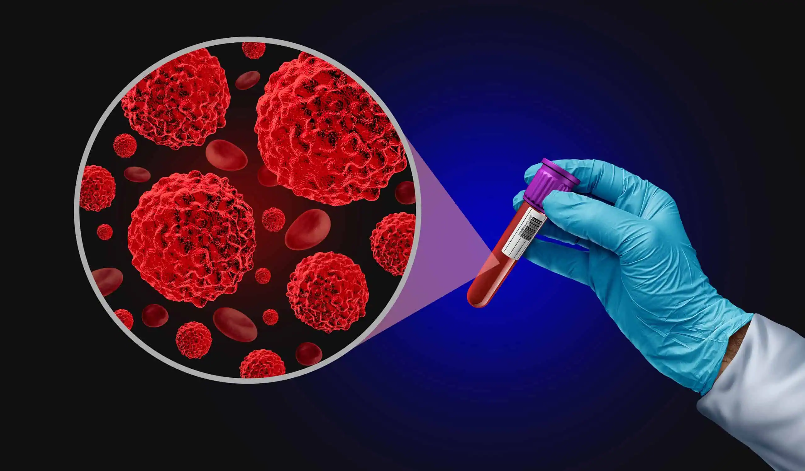 MHC and HLA on umbilical cord mesenchymal stem cells